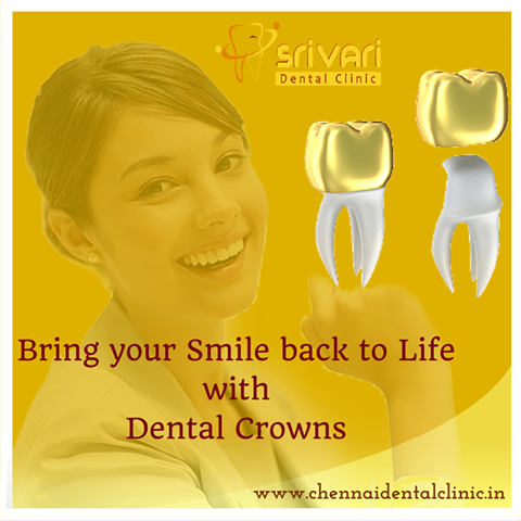 Enhance Your Teeth Appearance Using Golden Crown