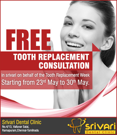 Tooth-replacement-consultation