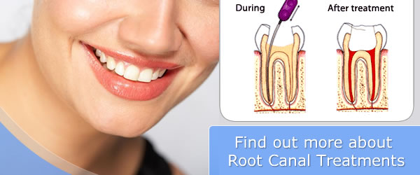 How to Prevent Decaying Teeth ?