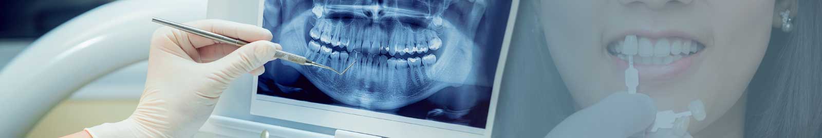 Dental infections treatment