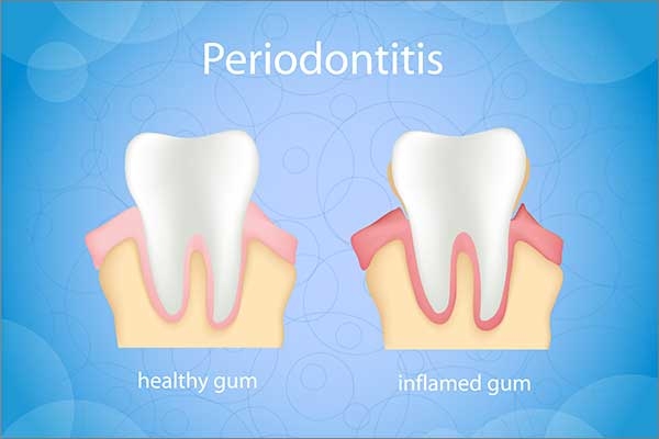 periodontist