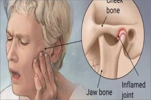 temporomandibular disorder (tmd)