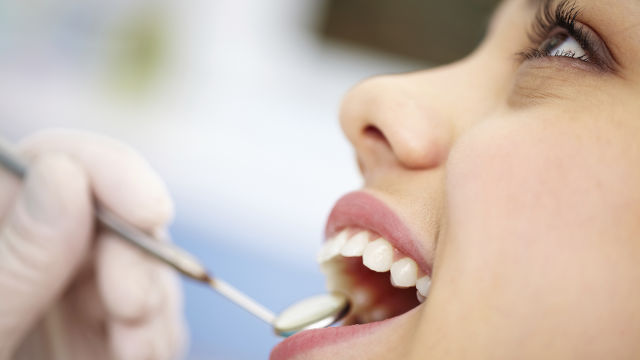 dental fillings