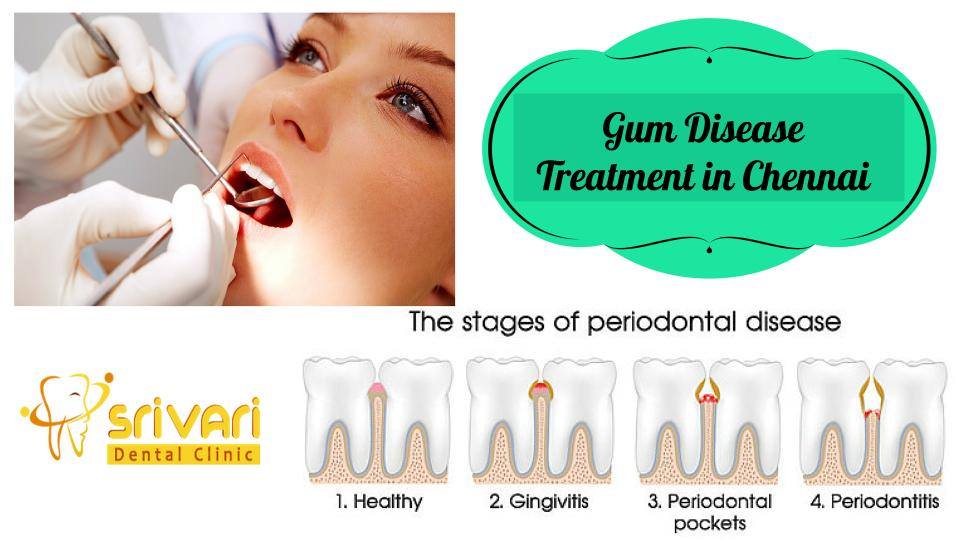 periodontist