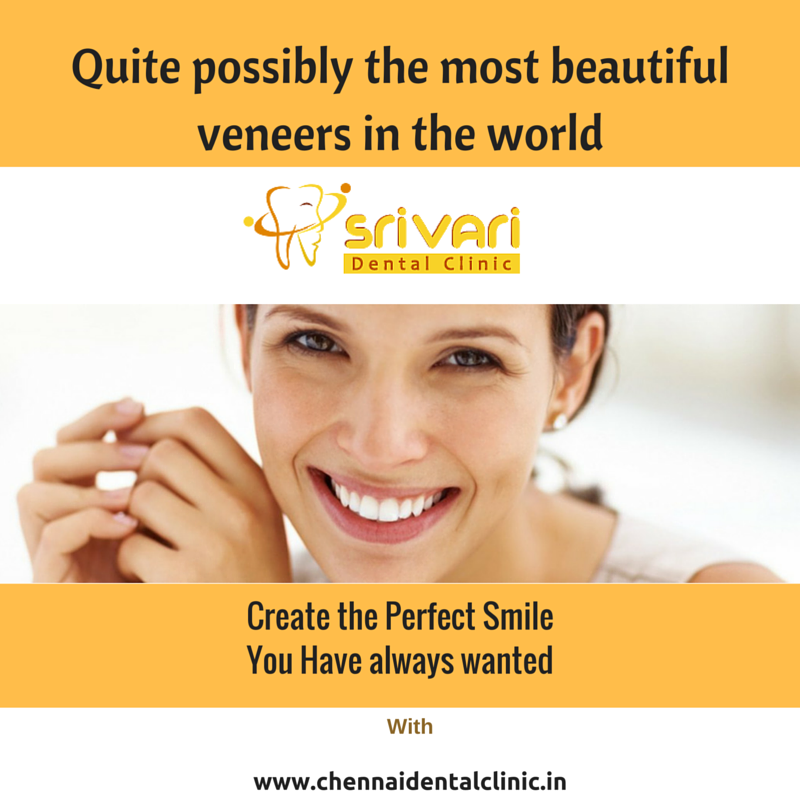 Dental veneers